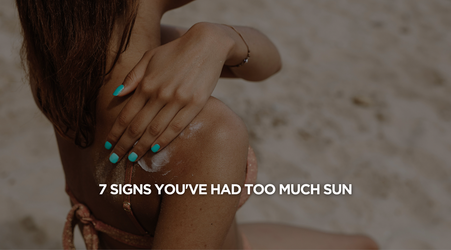 7 Signs You've Had Too Much Sun