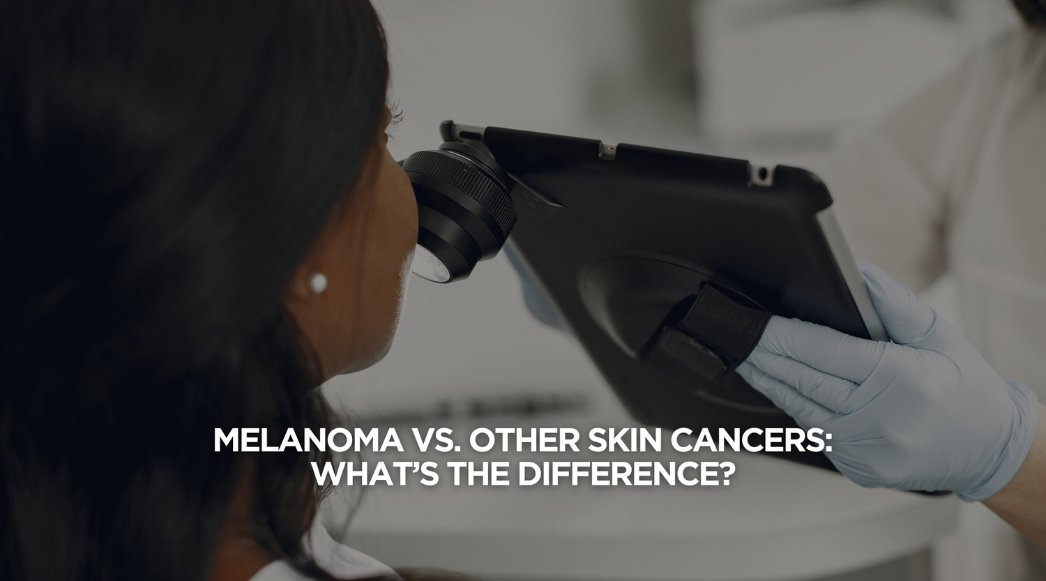 Melanoma vs. Other Skin Cancers: What’s the Difference?