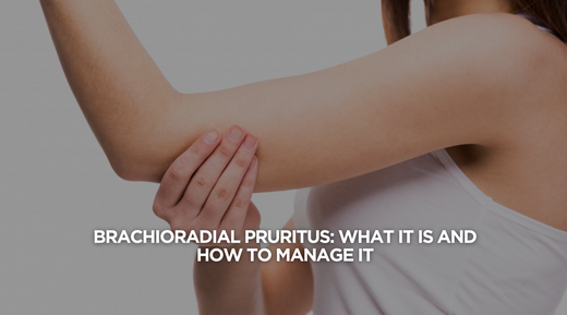Understanding Brachioradial Pruritus: What It Is and How to Manage It