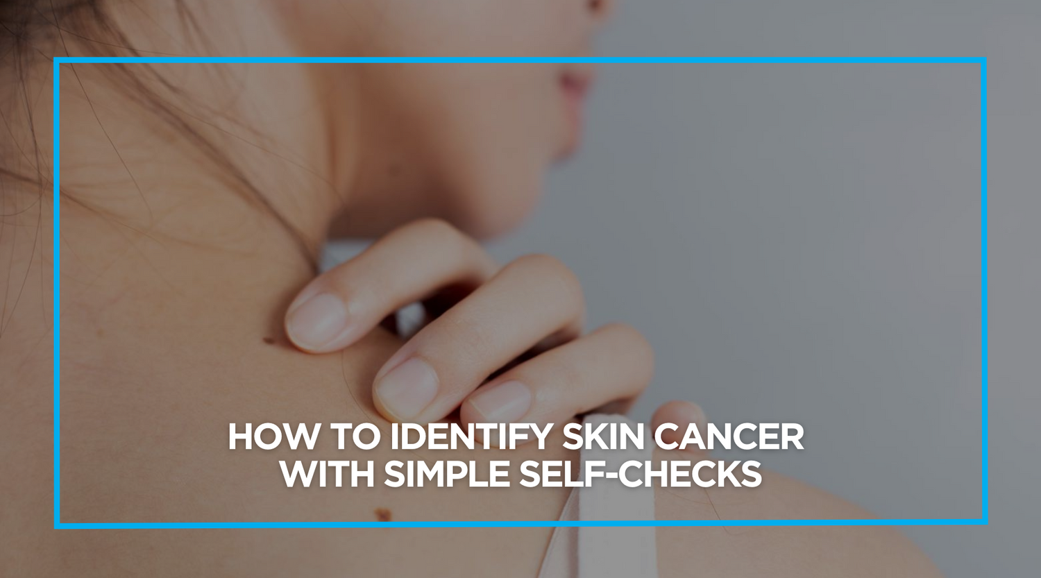 How to Identify Skin Cancer with Simple Self-Checks