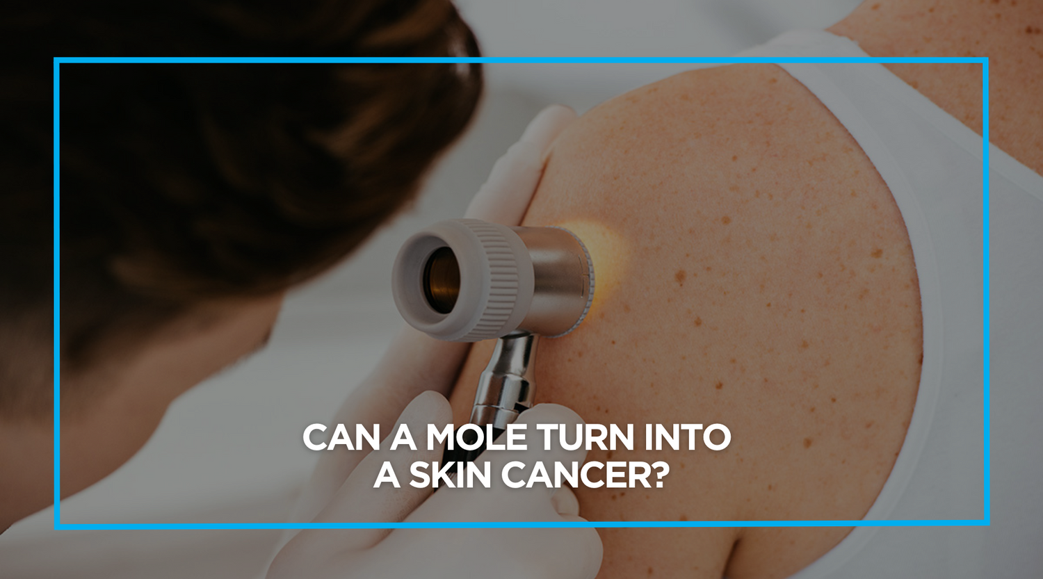 Can a mole turn into a skin cancer?