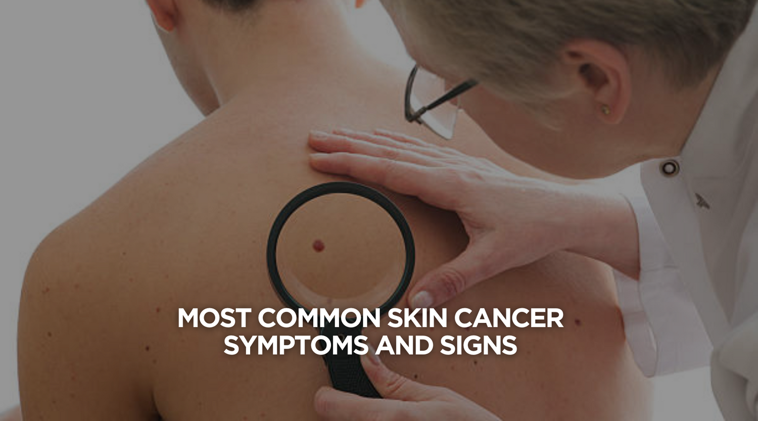 Most Common Skin Cancer Symptoms and Signs