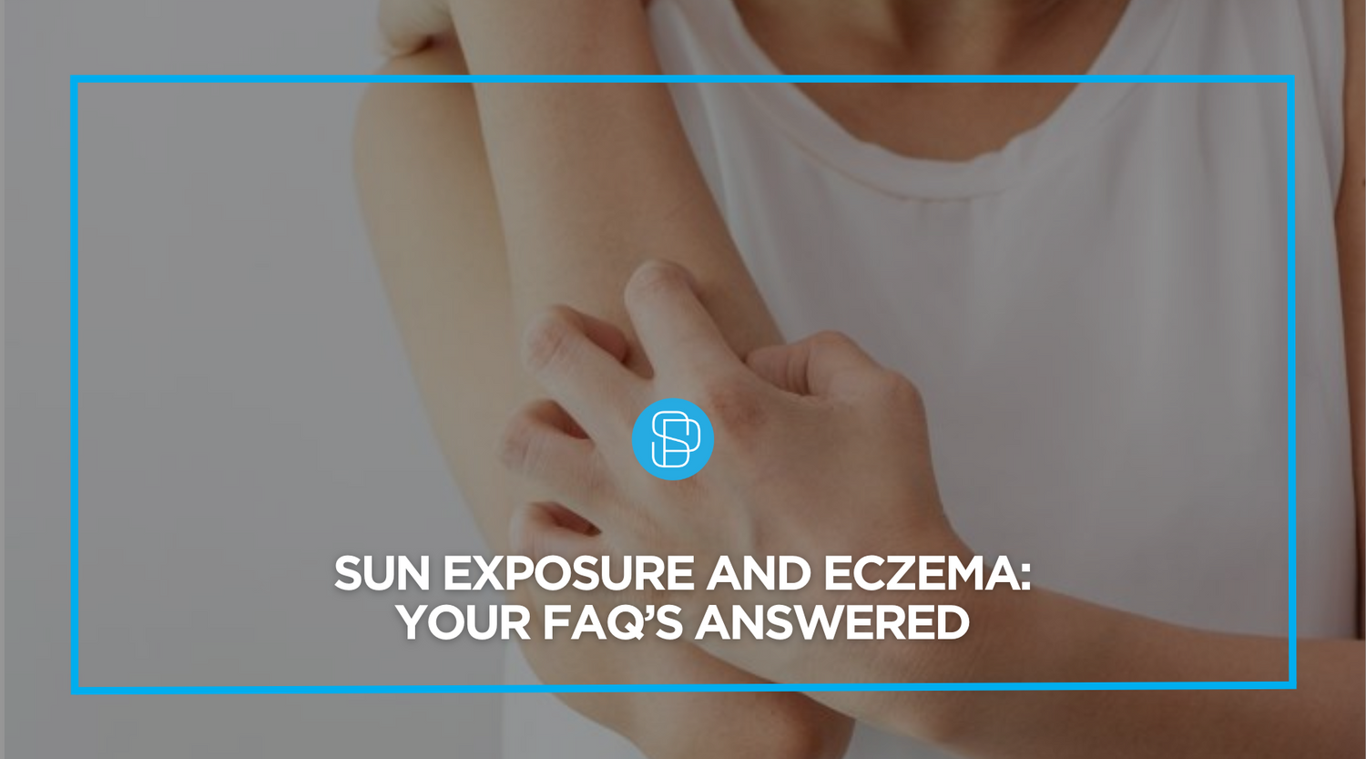 Sun Exposure and Eczema