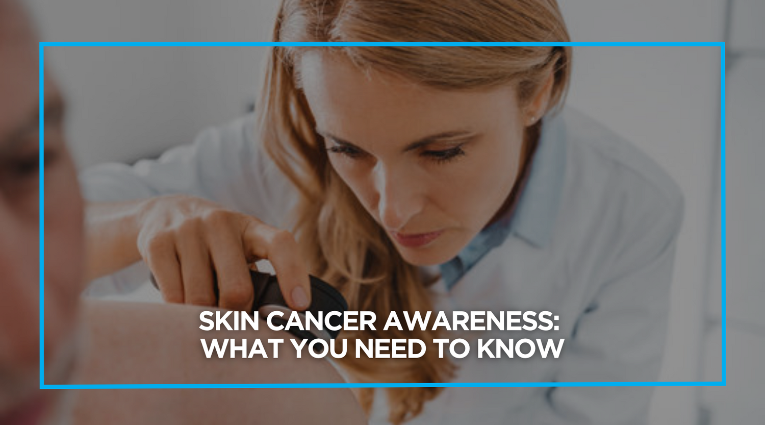 Skin Cancer Awareness: What You Need to Know