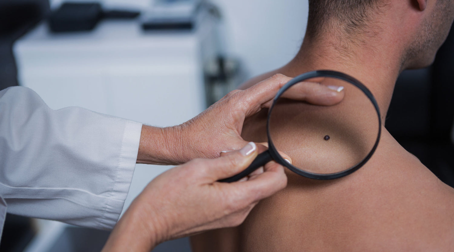 Have You Done Your Mid-Year Skin Check Yet?